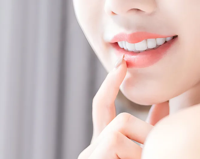 치아미백
