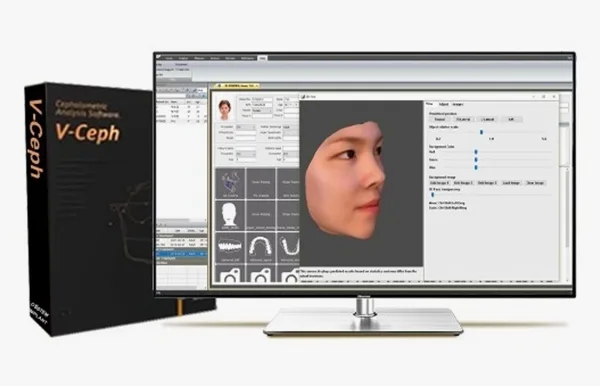 V-Ceph 얼굴뼈 분석 프로그램 화면