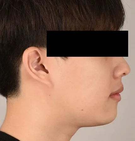 청소년 교정 후