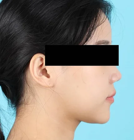 재교정 후