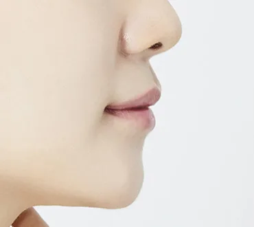 교정 전